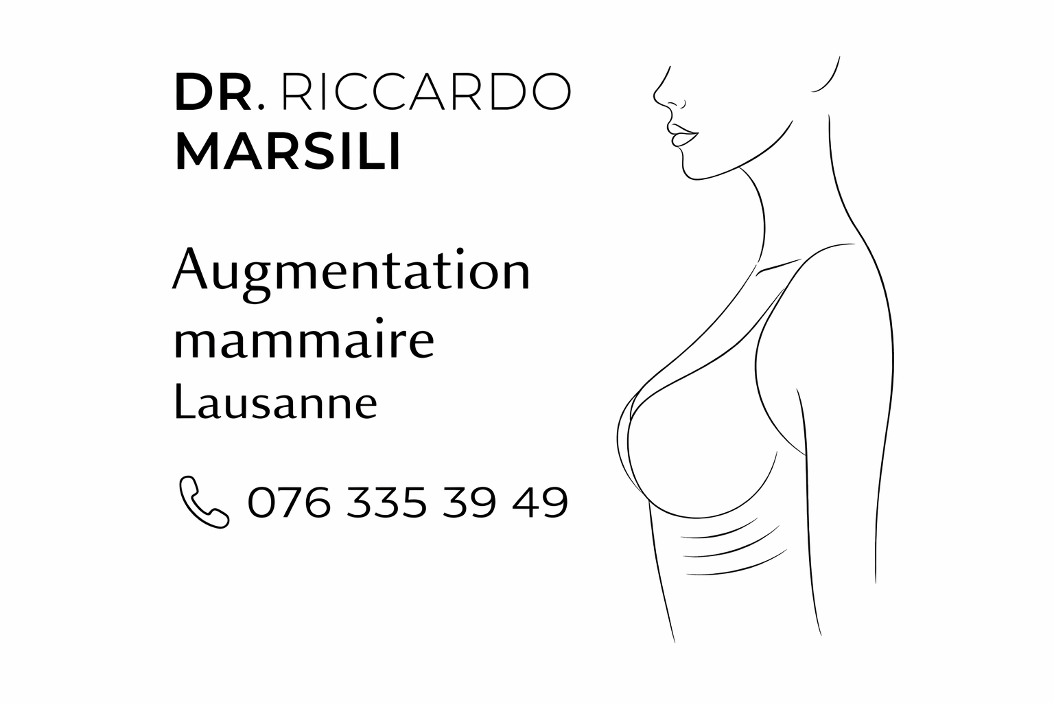 Augmentation mammaire par implants Lausanne
