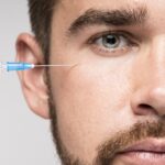 Injections esthétique PRP en Suisse