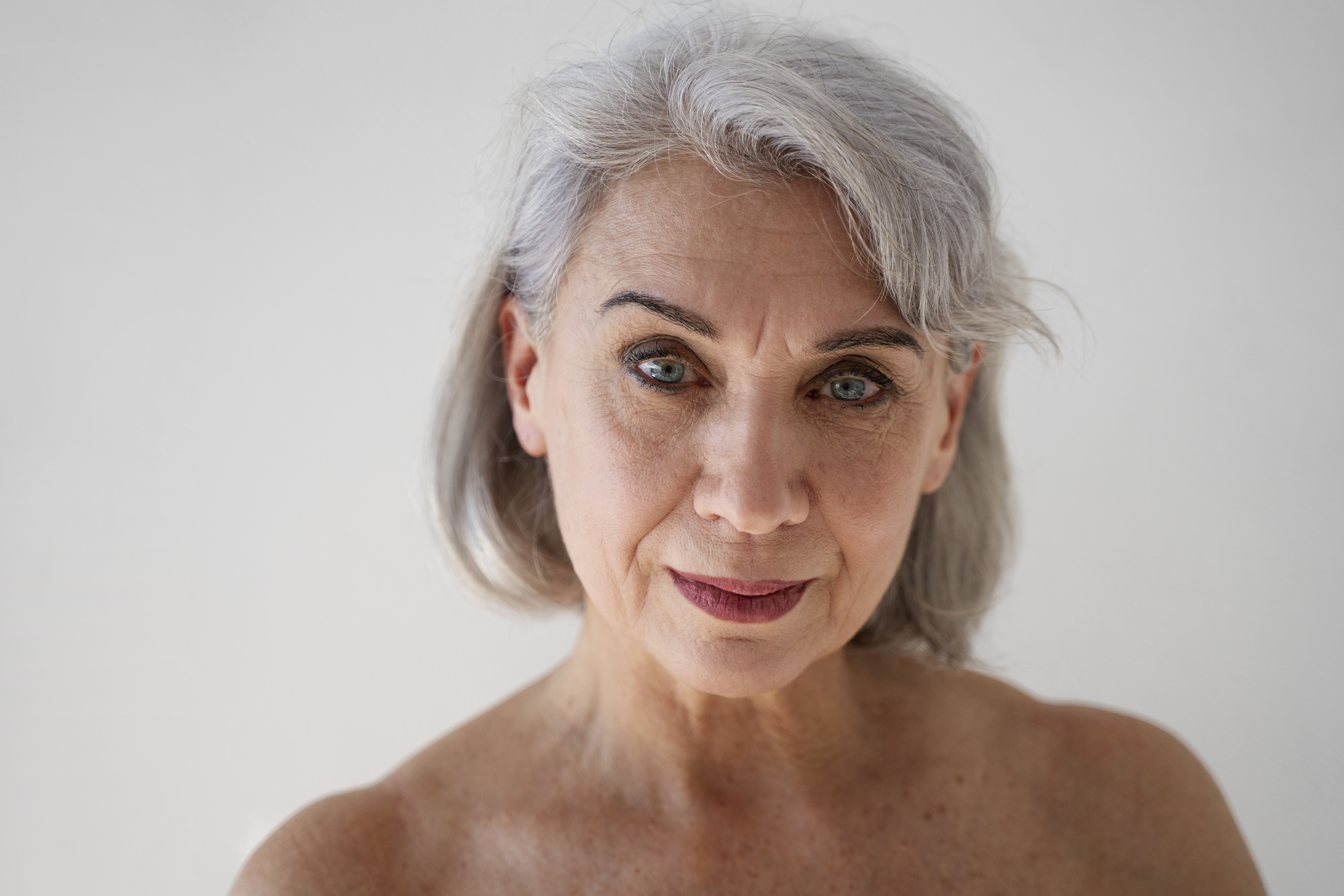 Injections esthétiques avec Sculptra en Suisse