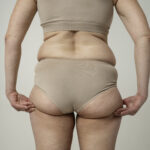 Des questions sur la liposuccion