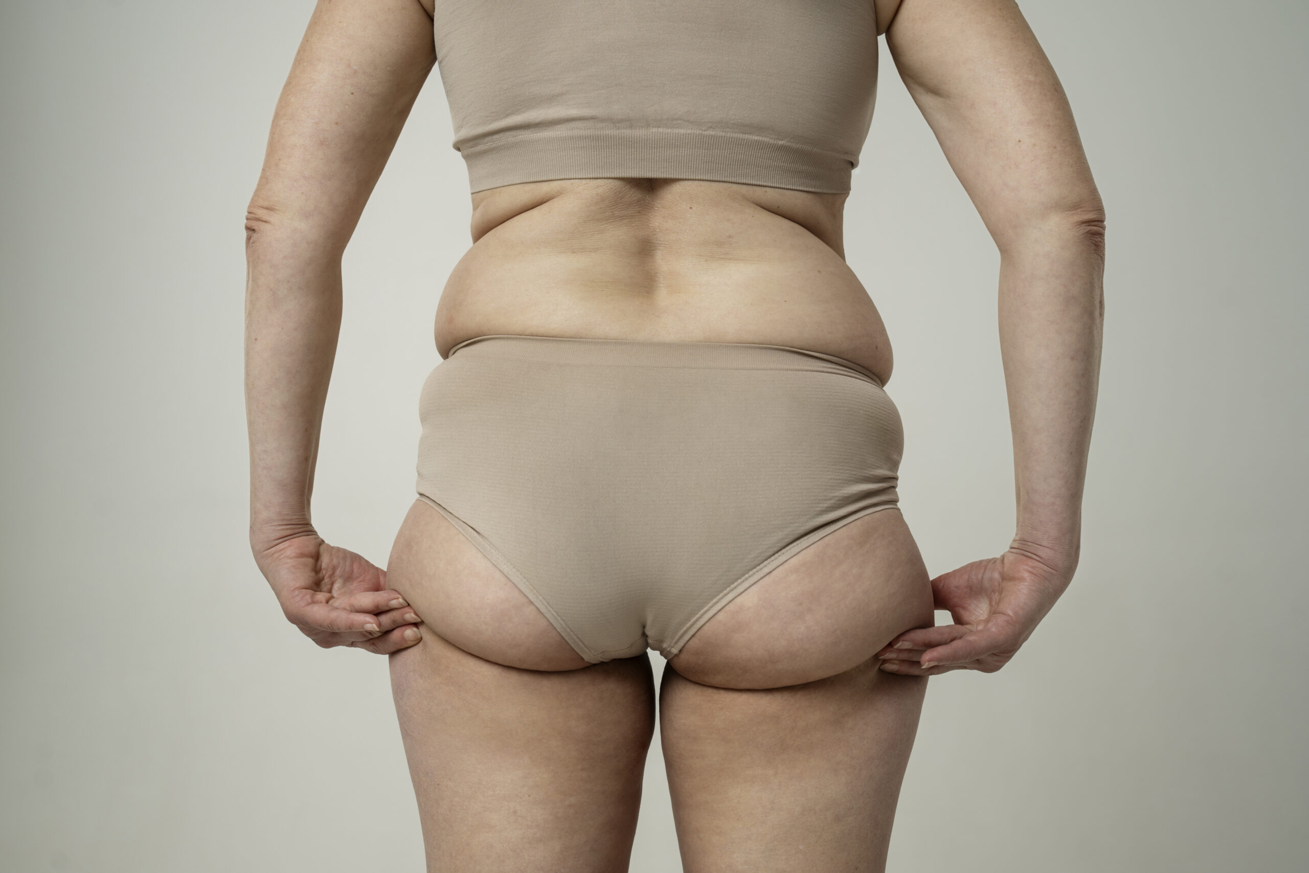 Des questions sur la liposuccion